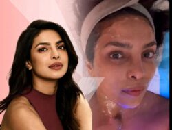 Priyanka Chopra Jonas Pilih XERF, Treatment Skin Tightening yang Lagi Naik Daun