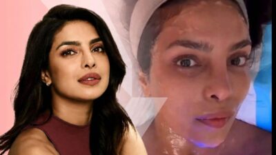 Priyanka Chopra Jonas Pilih XERF, Treatment Skin Tightening yang Lagi Naik Daun